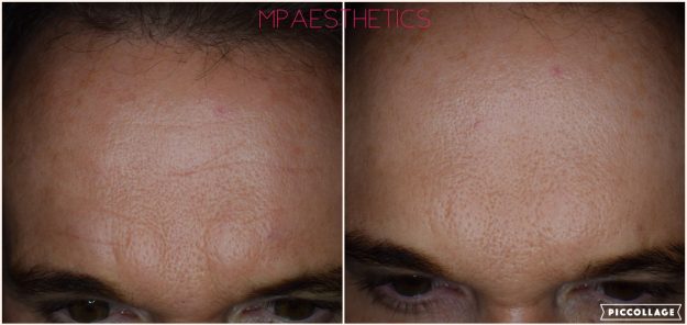 Line Reduction in Newton Abbot